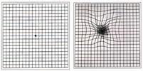 Click here for the amsler grid